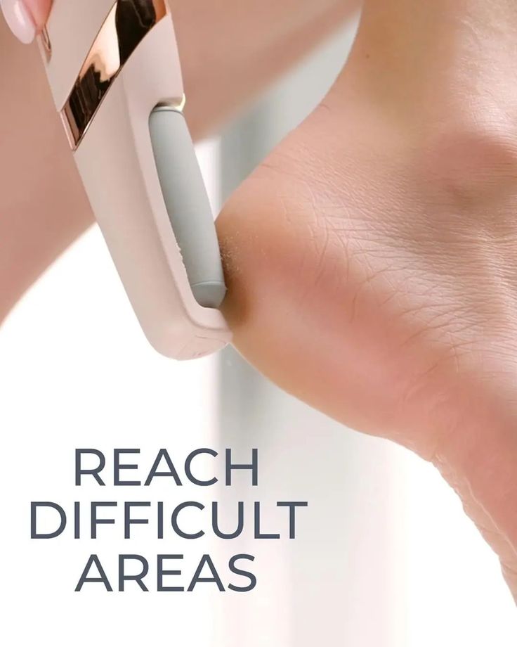 jugnuu| Electric Foot Callus Remover – Rechargeable Pedicure File for Dead Skin, Cracked Heels & Smooth Feet