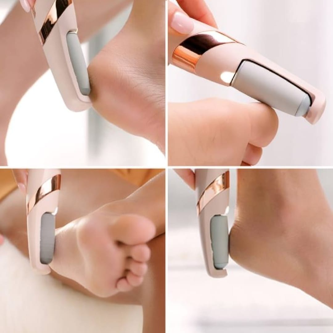 jugnuu| Electric Foot Callus Remover – Rechargeable Pedicure File for Dead Skin, Cracked Heels & Smooth Feet