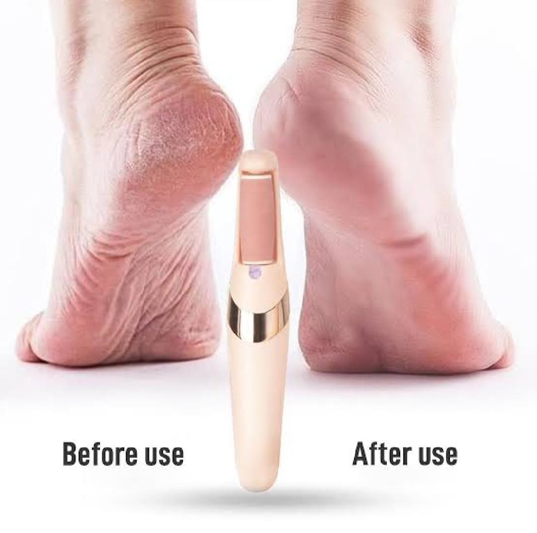 jugnuu| Electric Foot Callus Remover – Rechargeable Pedicure File for Dead Skin, Cracked Heels & Smooth Feet