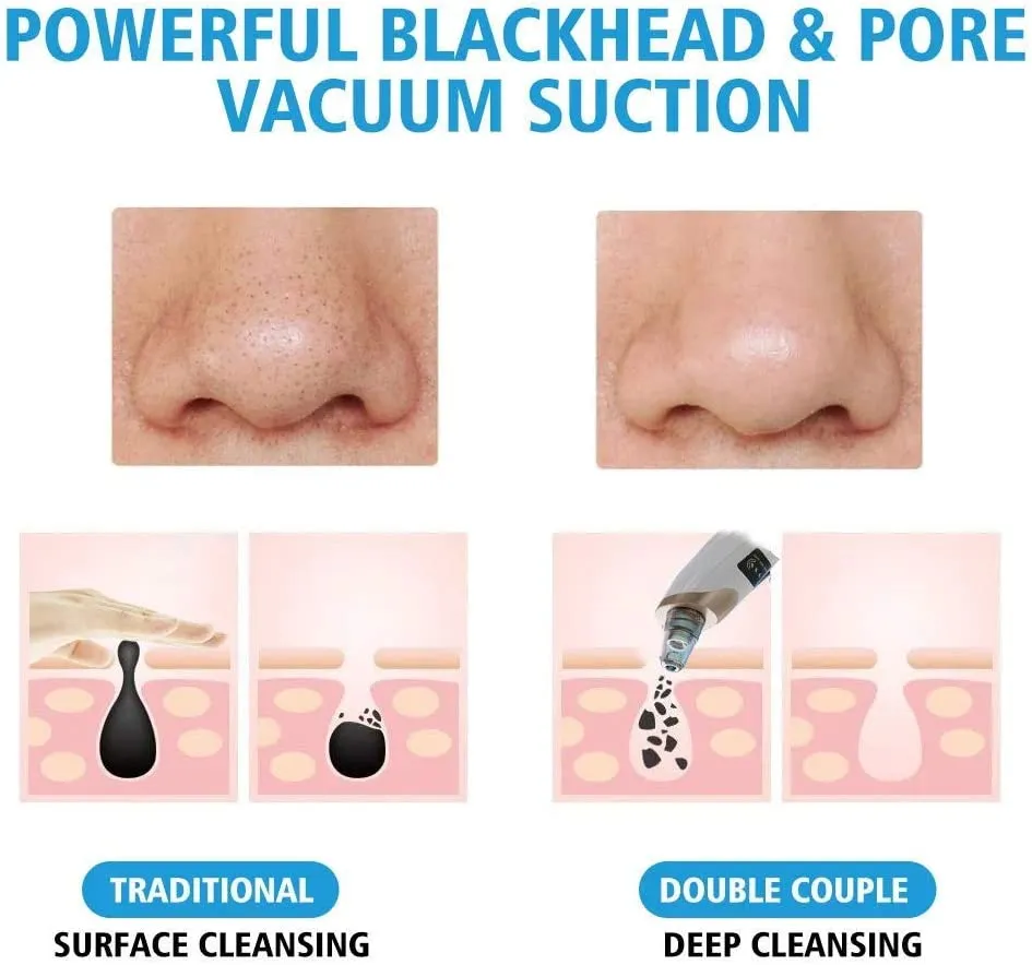 Jugnuu | Ultimate Multifunction Blackhead Remover – 5-in-1 Deep Pore Cleansing & Skin Revitalization